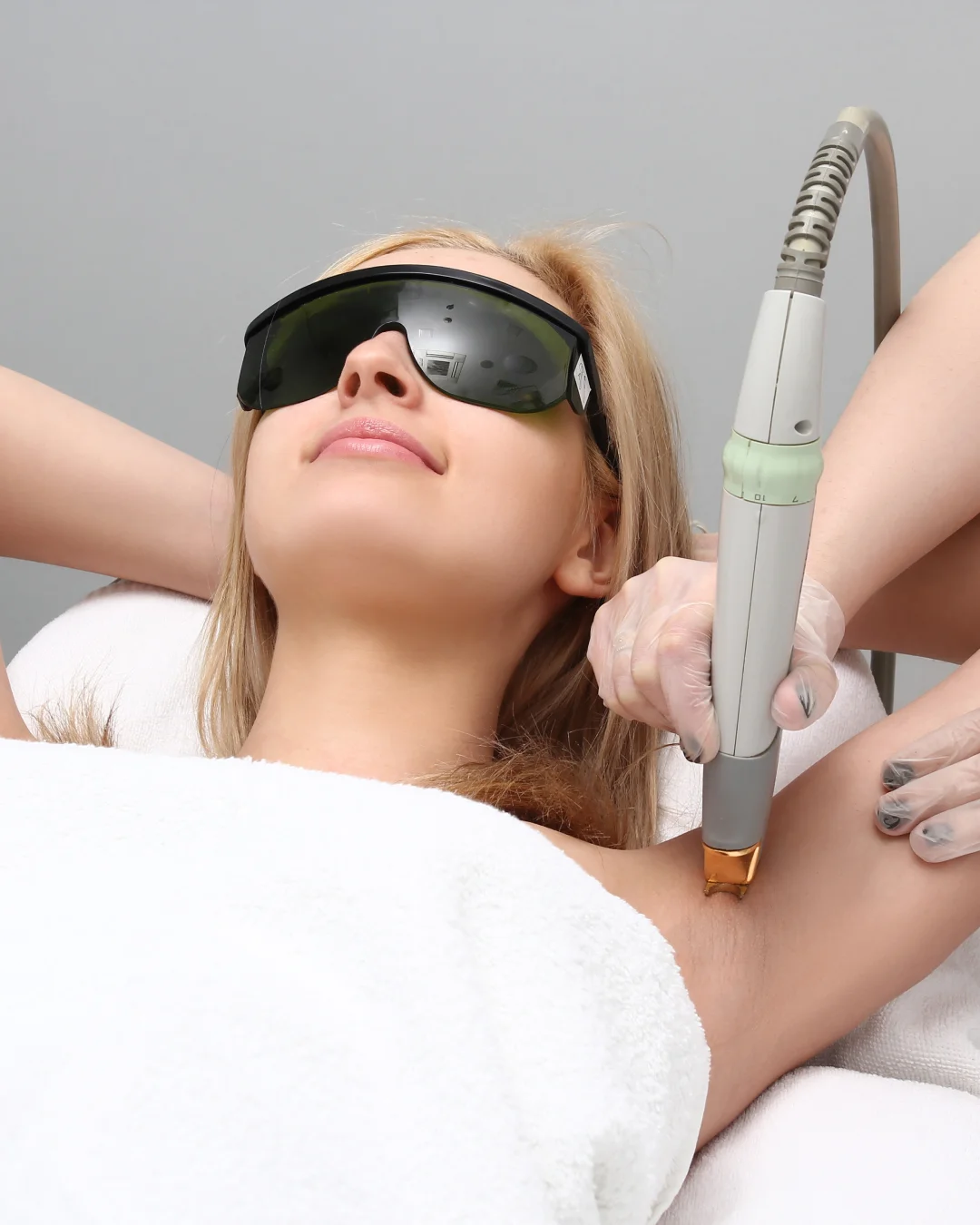 Candela Laser Hair Removal