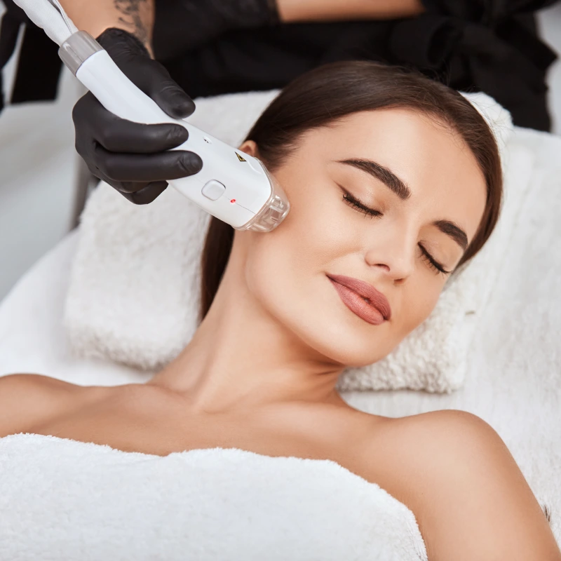 IPL Photo Rejuvenation