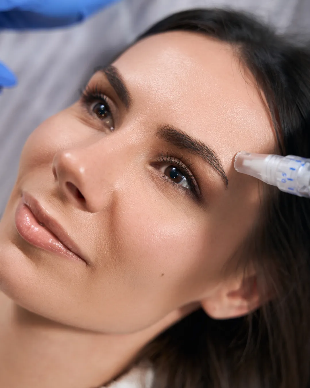 Microneedling Treatments in Great Neck, NY at Evolve Spa