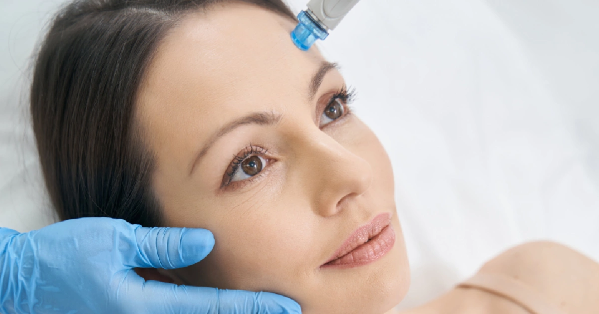 High-angle close-up of a woman receiving a forehead HydraFacial® in Great Neck, NY, with blue-gloved hands using a device.